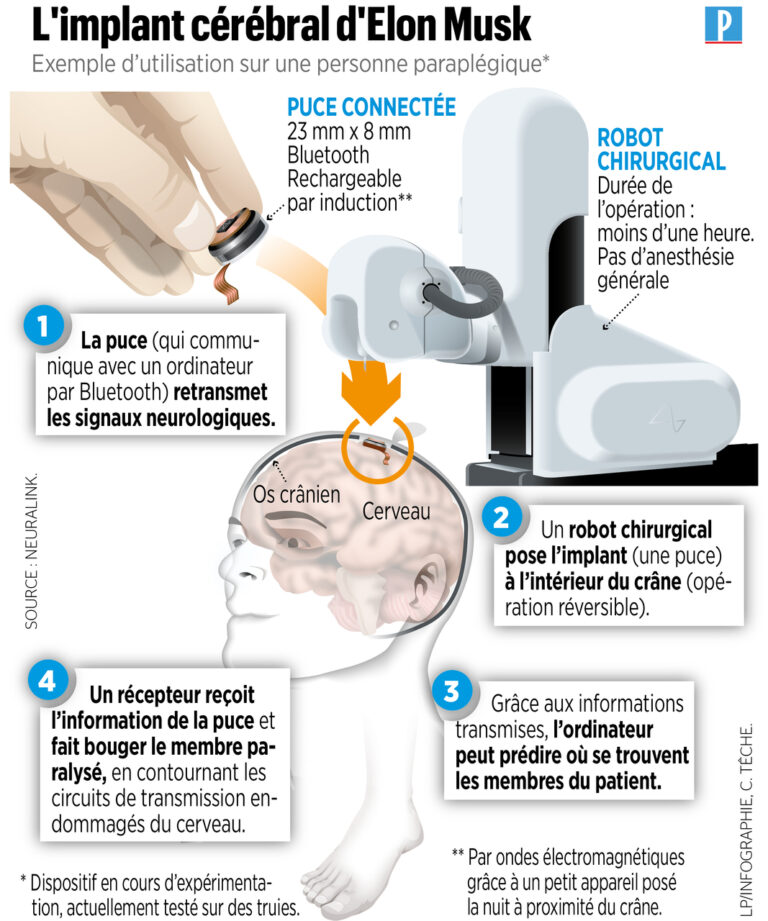 Technologie Neuralink : un patient paralysé gagne en autonomie grâce à l’implant cérébral